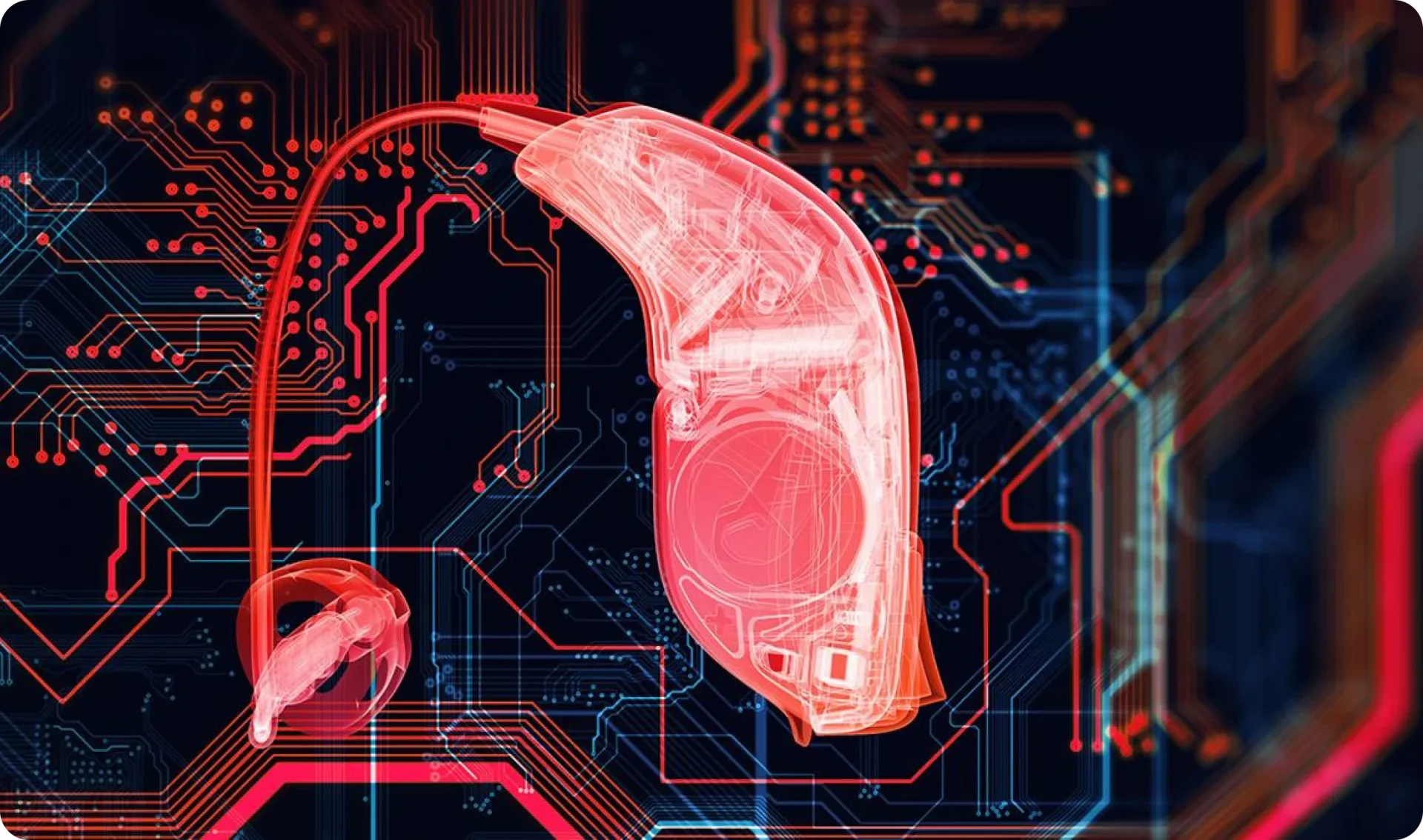 Bernafon DECS™ Technologie