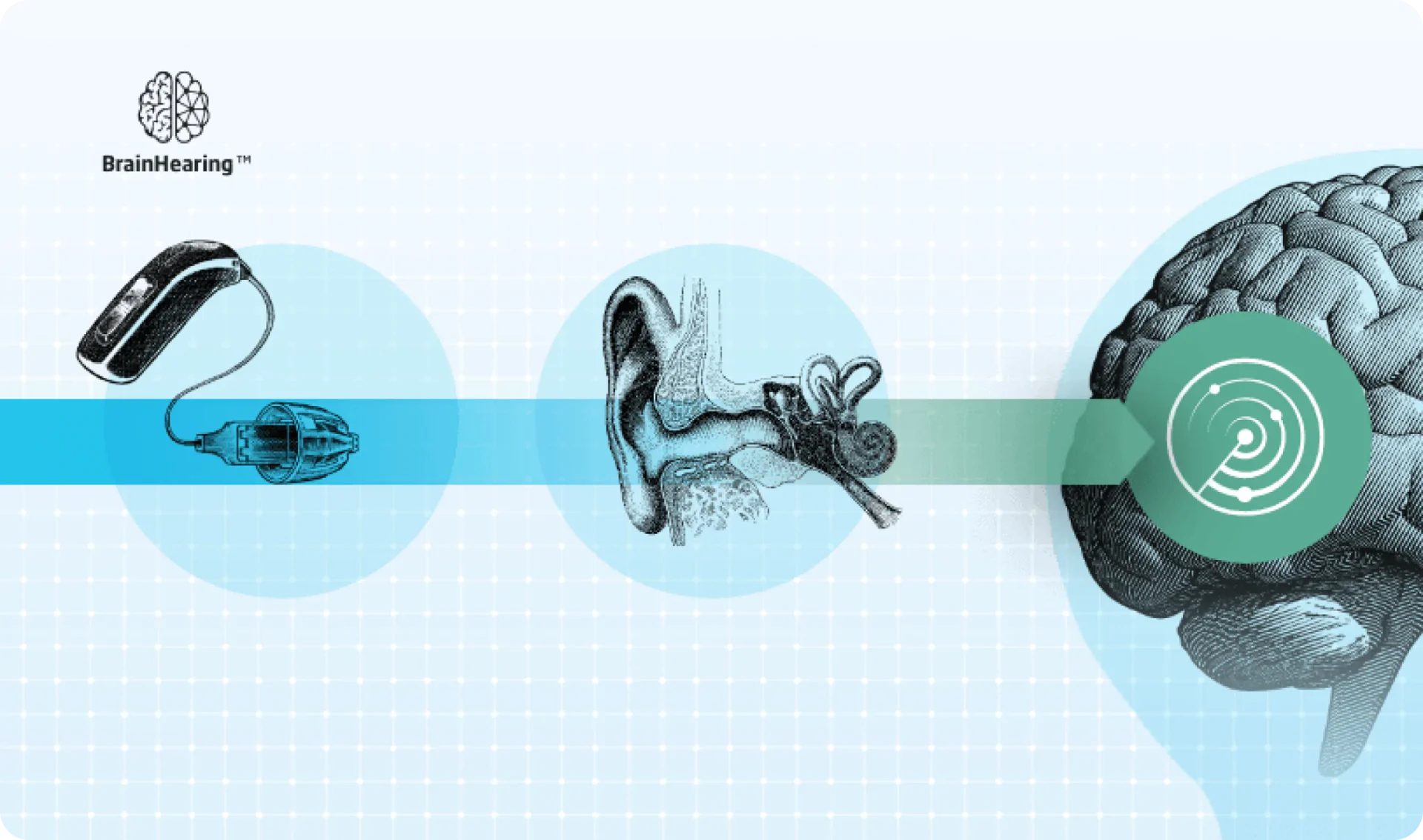Brain Hearing von Oticon